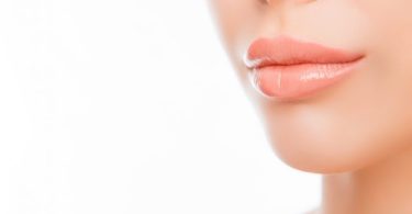 How Long Do Your Lips Stay Swollen After Injections